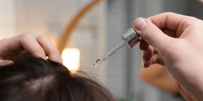 自毛植毛と他の薄毛治療の違い