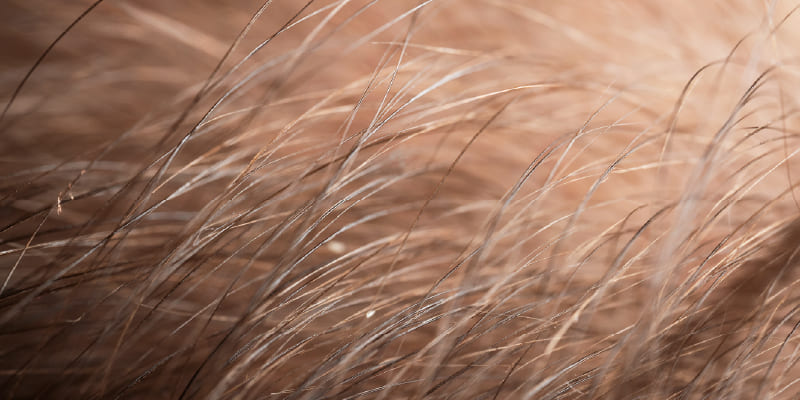 植毛は「永久に定着する」のか？