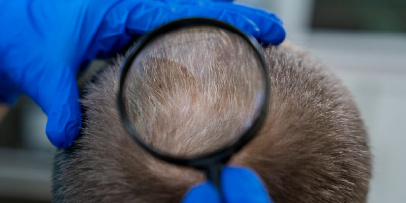 術後10年・20年後の経過はどうなるのか