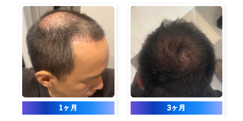 ショックロスは一時的な経過、正しいケアで回復可能