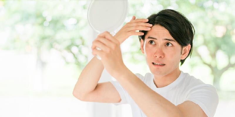 若ハゲを放置するとどうなるのか