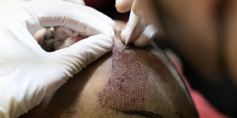 手術直後〜当日の痛み・違和感