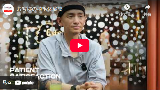 植毛は実際どうだったのか？経験者のリアルな声1