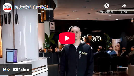 植毛は実際どうだったのか？経験者のリアルな声2