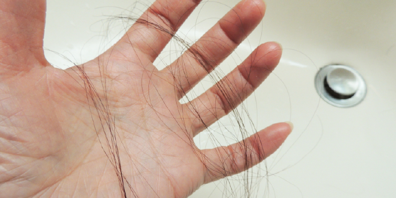 薄毛の進行パターンは人によって違う