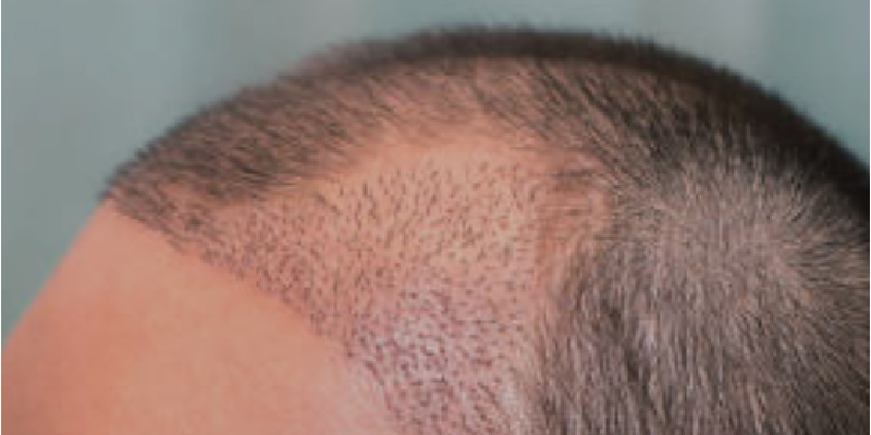 1株あたりのコスト比較