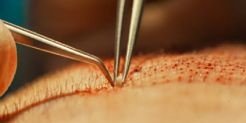 価格だけでなく「内容差」も大きい