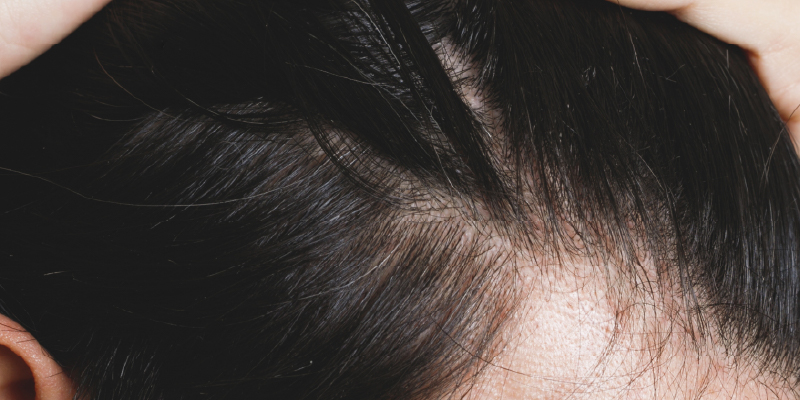 密度こそ自然な仕上がりの決め手