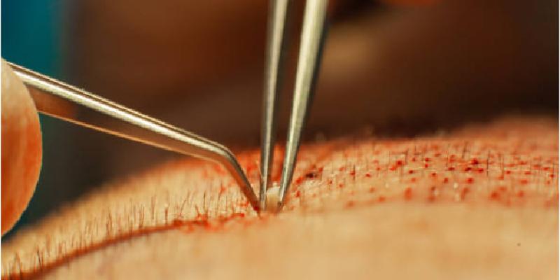 トルコの高密度技術が可能にする世界