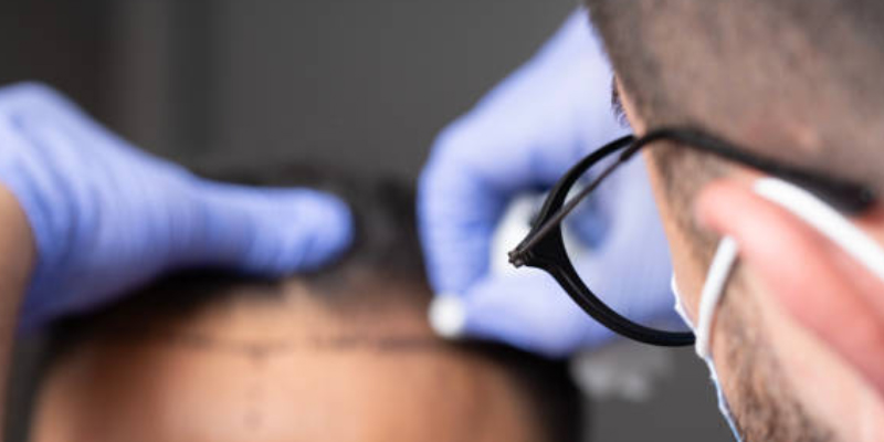 植毛デザイン力の違い