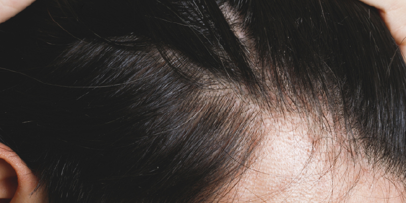 高密度を無理に追求した失敗症例