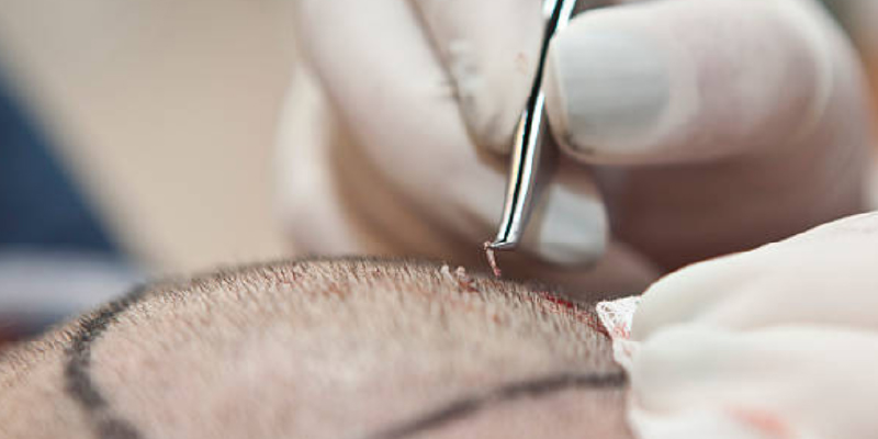 若年と高齢で違うデザイン設計