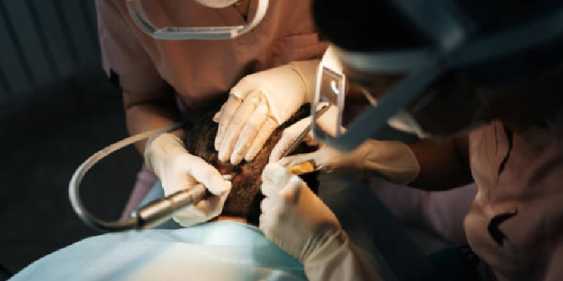 トルコ植毛が生え際に強い理由