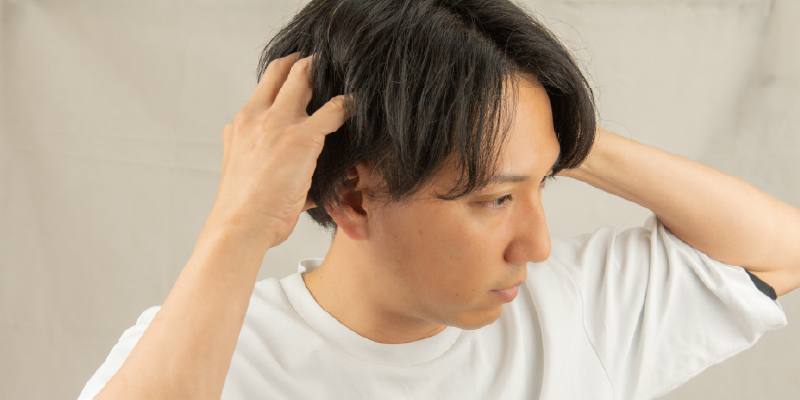 黄金比×角度×密度で「生え際の自然さ」は決まる