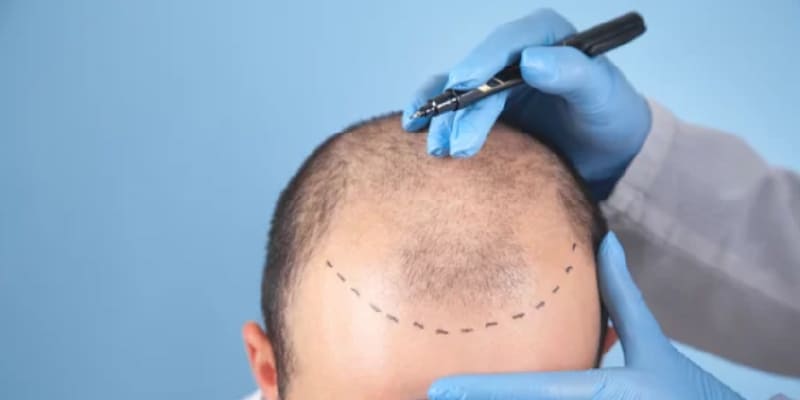 失敗の主な原因