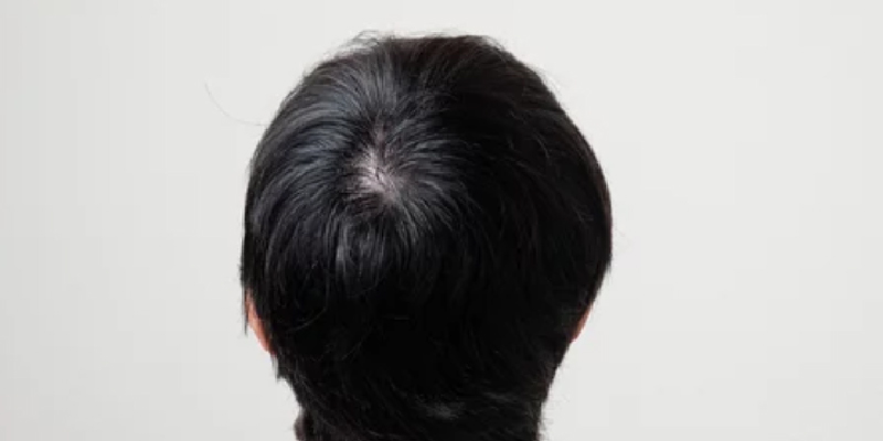 なぜ後頭部から採取するのかの説明