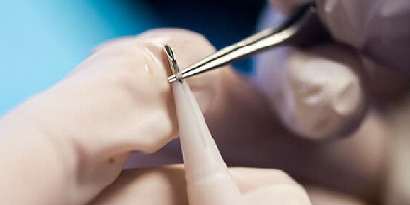 採取時・採取後の注意点