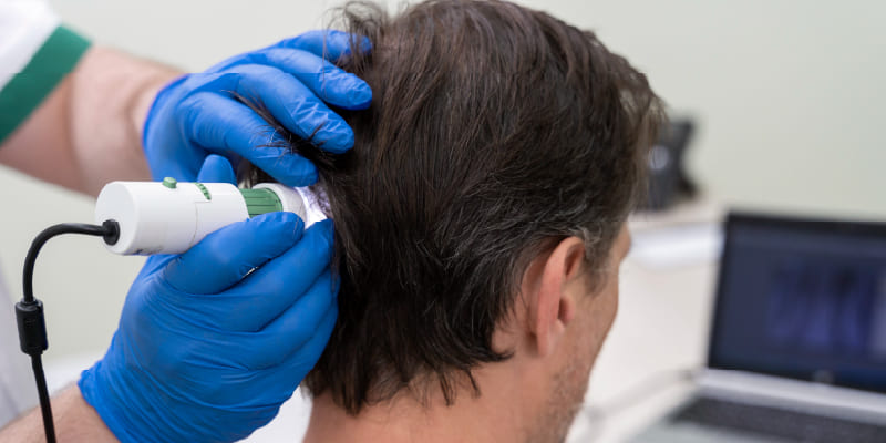 植毛後の未来を守るためにできること