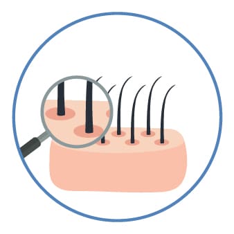 頭皮の状態確認と施術プランの策定