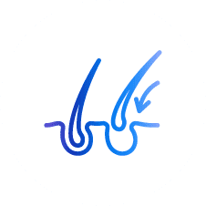 トルコ植毛施術日