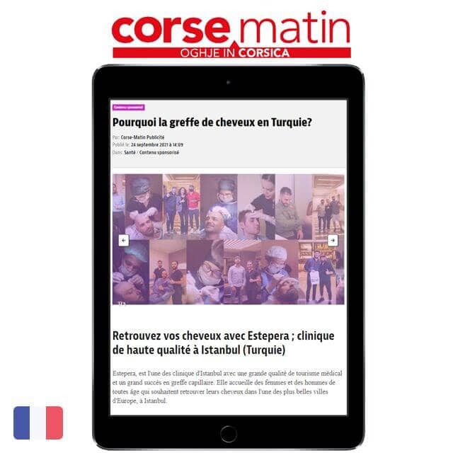 フランスの「Corse Matin」でエステペラの植毛が取り上げられました。
