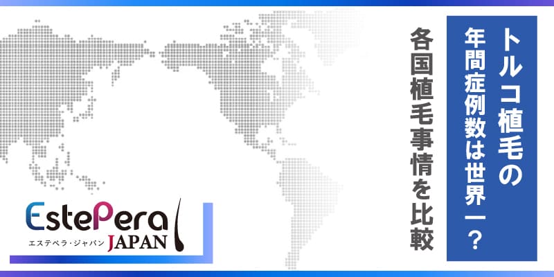 トルコ植毛の年間症例数は世界一？各国植毛事情を比較