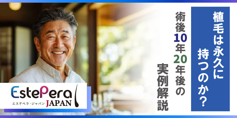 植毛は永久に持つのか？術後10年、20年後の実例解説