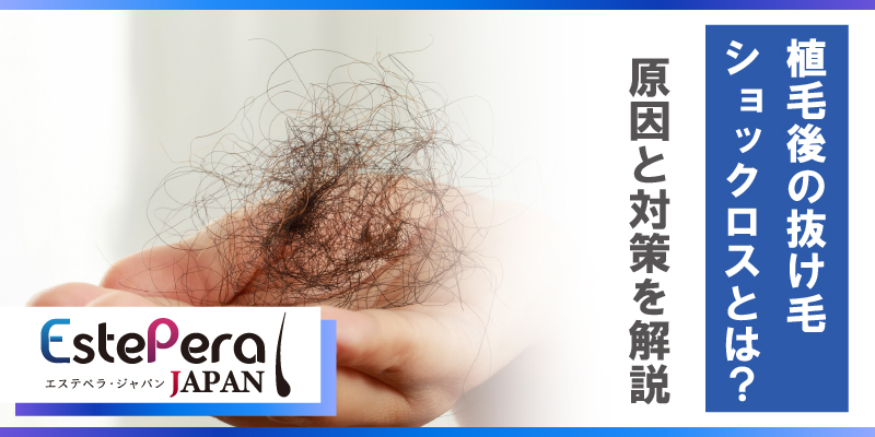 植毛後の抜け毛「ショックロス」とは？原因と対策を解説
