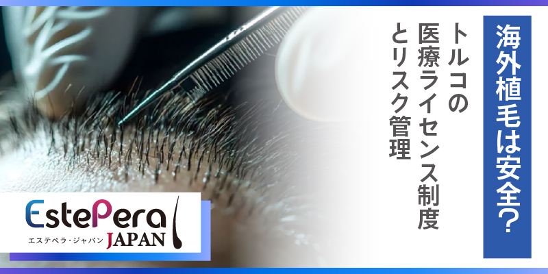 海外植毛は安全？トルコの医療ライセンス制度とリスク管理