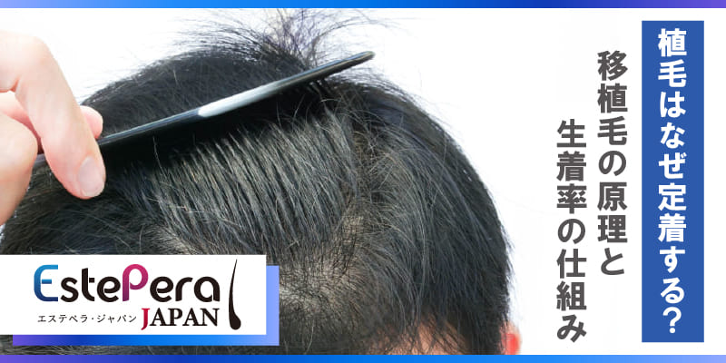植毛はなぜ定着する？移植毛の原理と生着率の仕組み