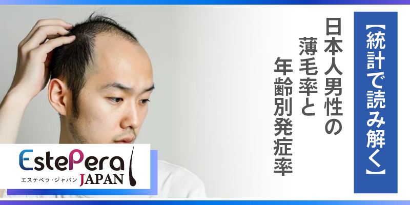 【統計で読み解く】日本人男性の薄毛率と年齢別発症率