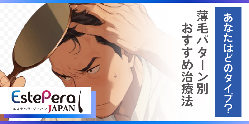 あなたはどのタイプ？薄毛パターン別おすすめ治療法