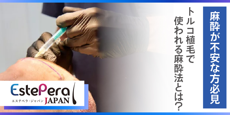 麻酔が不安な方必見！トルコ植毛で使われる麻酔法とは？
