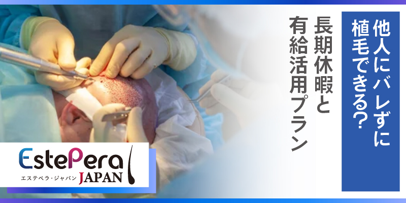 他人にバレずに植毛できる？長期休暇と有給活用プラン