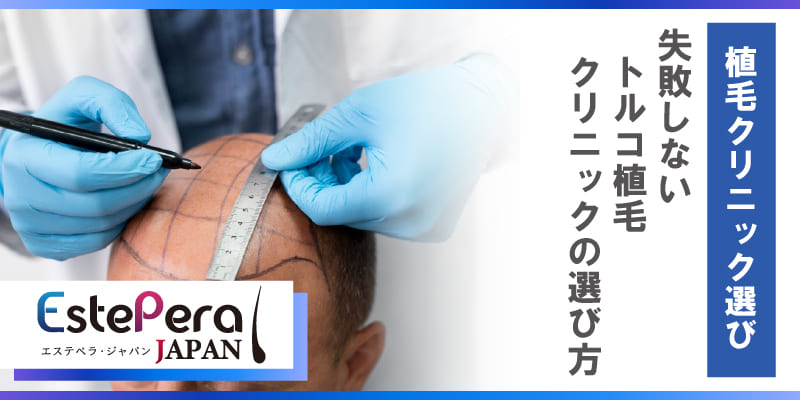 植毛クリニック選びで失敗しないための7つのポイント