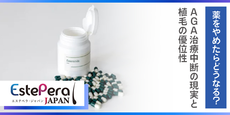 薬をやめたらどうなる？AGA治療中断の現実と植毛の優位性