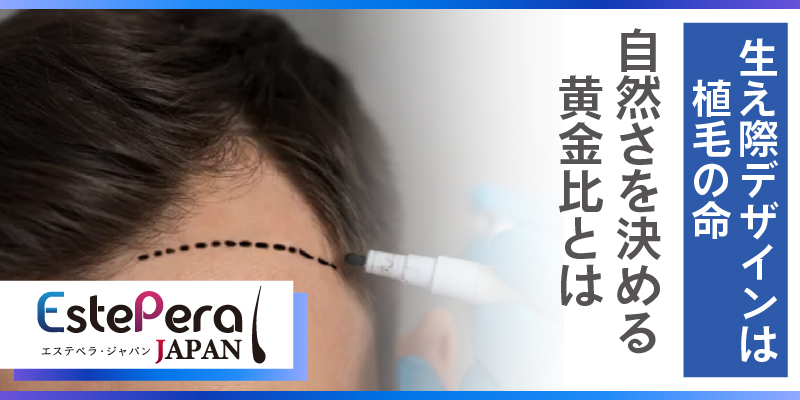 『生え際デザインは植毛の命』自然さを決める黄金比とは