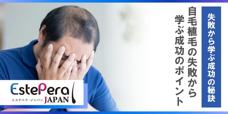 自毛植毛の失敗例から学ぶ成功のポイント