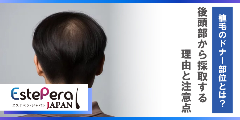 植毛のドナー部位とは？後頭部から採取する理由と注意点