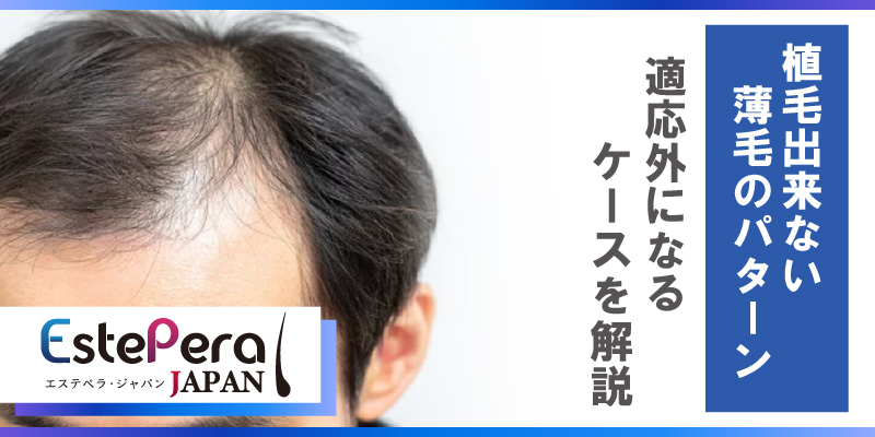 植毛できない薄毛パターンとは？適応外になるケースを解説